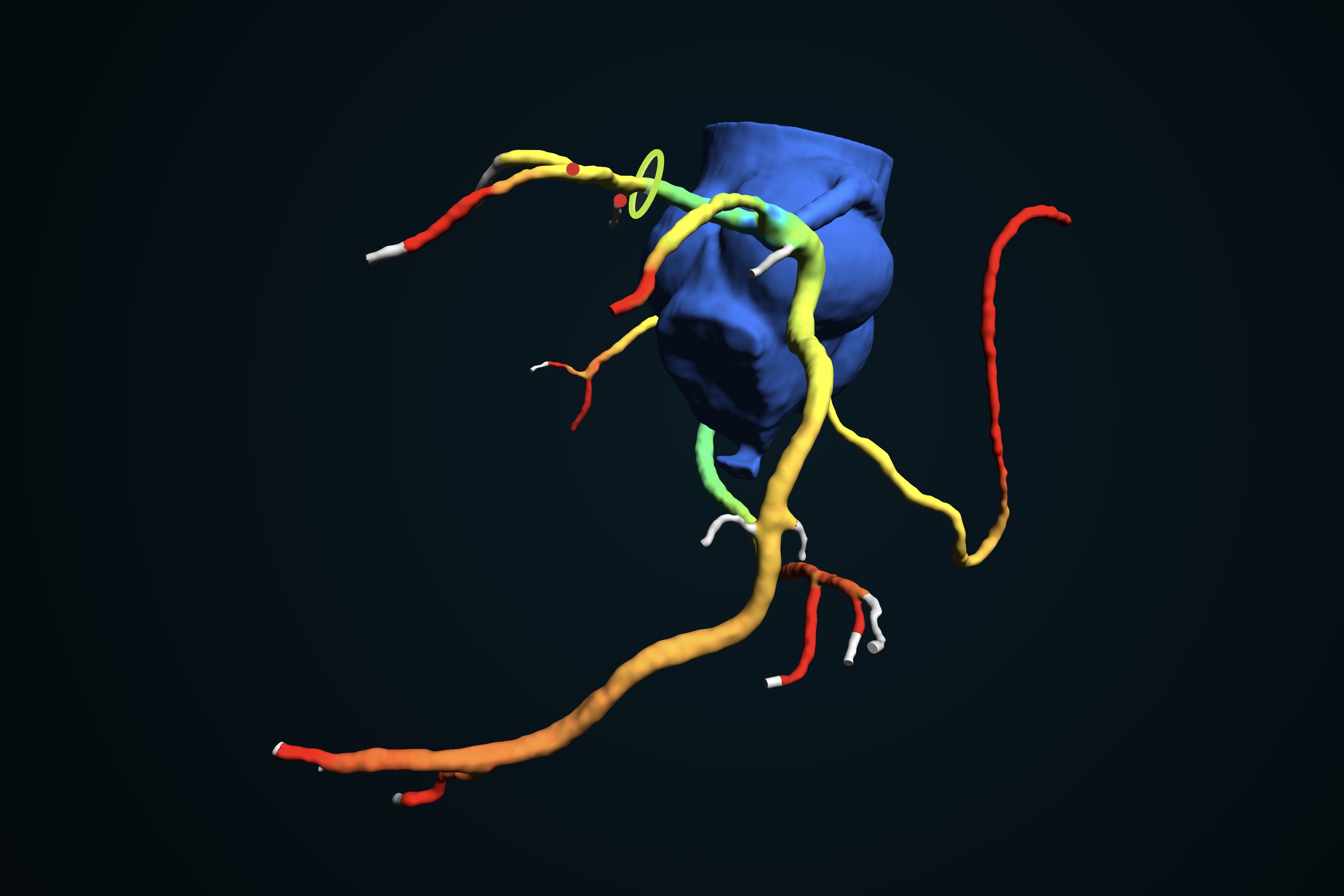 CFD simulation